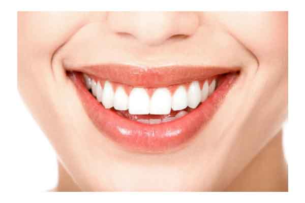 blanqueamiento dentista clinica dental molina de segura