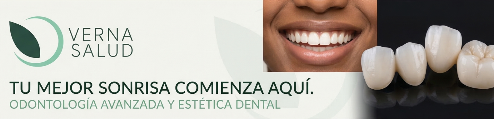 Banner de Verna Salud Odontología en Molina de Segura, con logo, primer plano de sonrisa perfecta y prótesis dentales de vanguardia.
